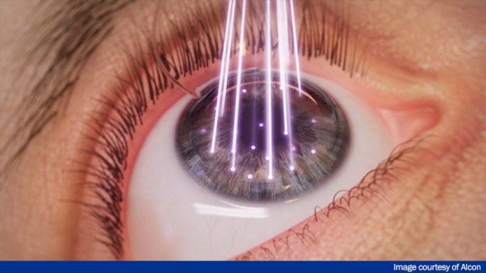 1. Final_Alcon_Wavelight_Attributed_B Training at the Tip of the Spear